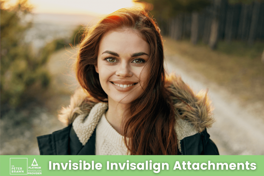 Invisible Invisalign Attachments - Dr. Peter Brawn