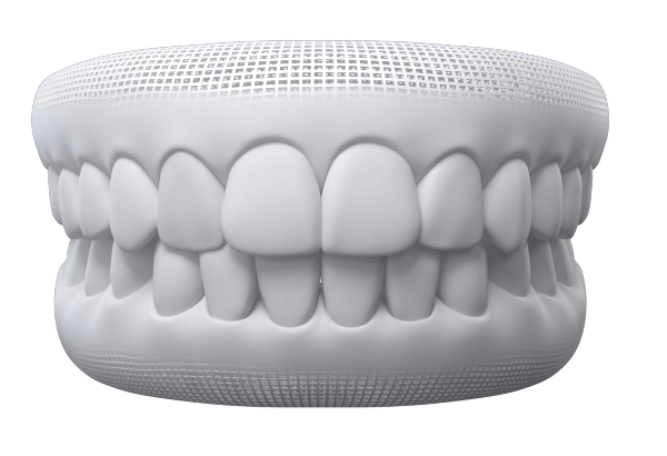 A smile with straight teeth after Invisalign treatment fixing overbite